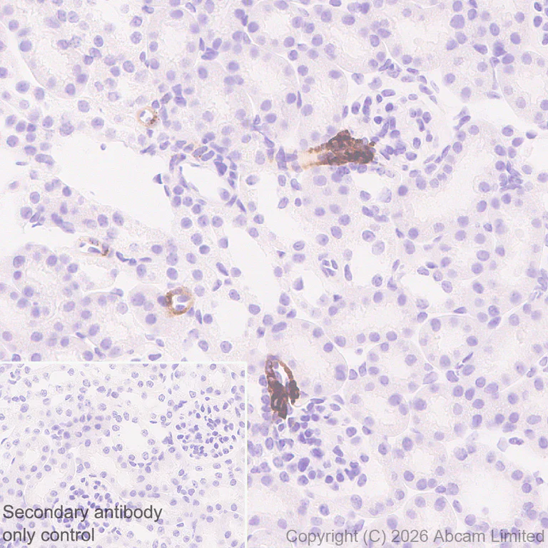 Immunohistochemistry (Formalin/PFA-fixed paraffin-embedded sections) - Anti-Renin-1+ Renin-2 antibody [EPR30219-25] (AB326049)