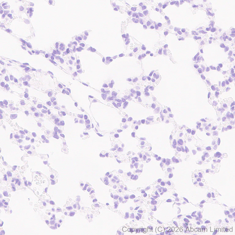 Immunohistochemistry (Formalin/PFA-fixed paraffin-embedded sections) - Anti-Renin-1+ Renin-2 antibody [EPR30219-25] (AB326049)