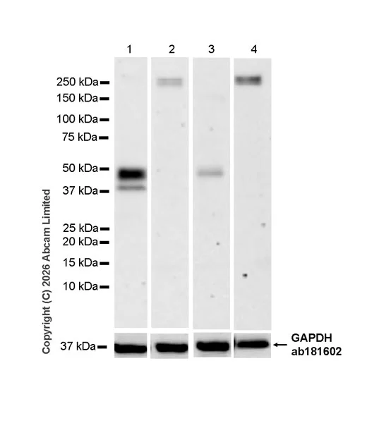 Western blot - Anti-Renin-1+ Renin-2 antibody [EPR30219-25] (AB326049)
