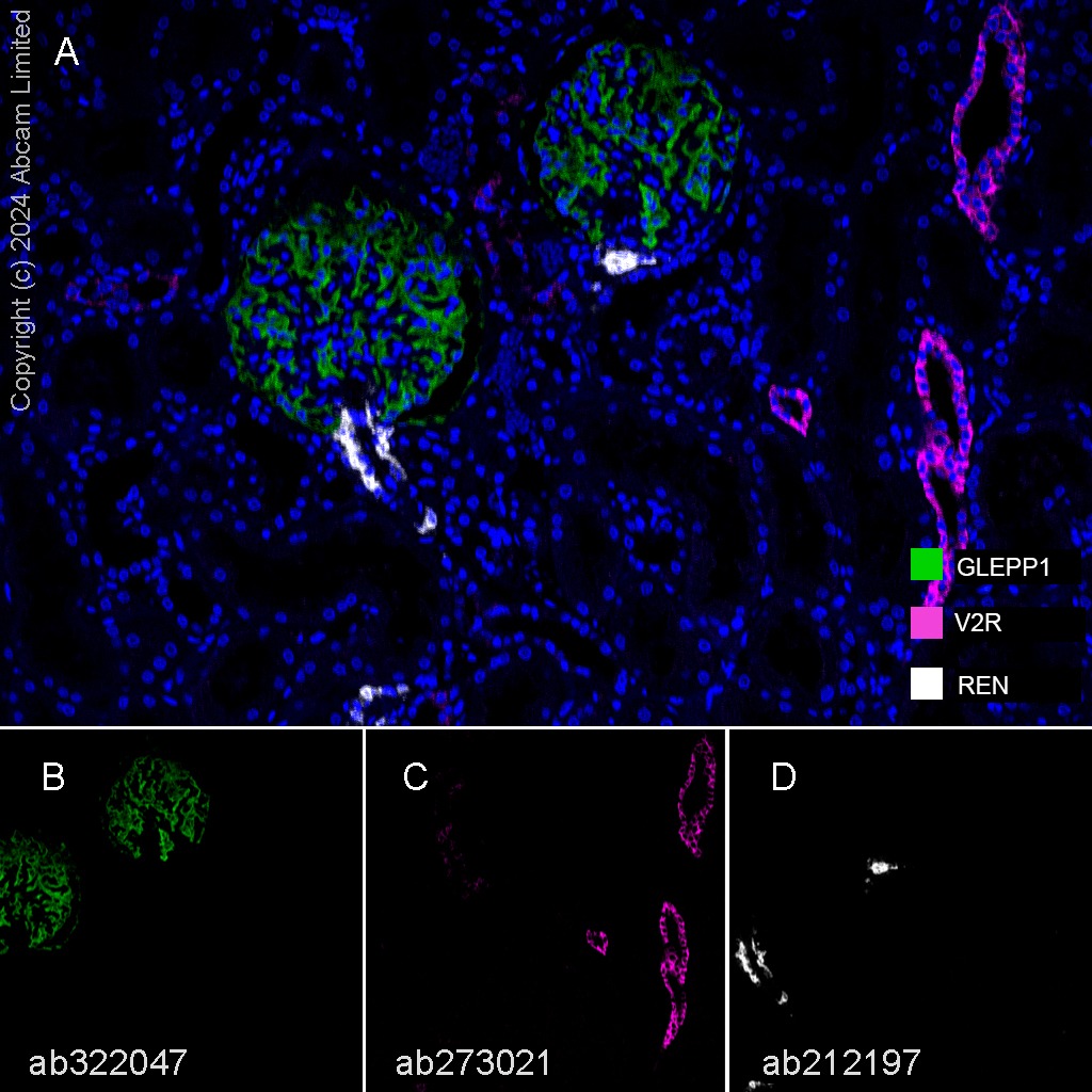 Anti-Renin antibody [EPR20693] Rabbit monoclonal (ab212197) | Abcam