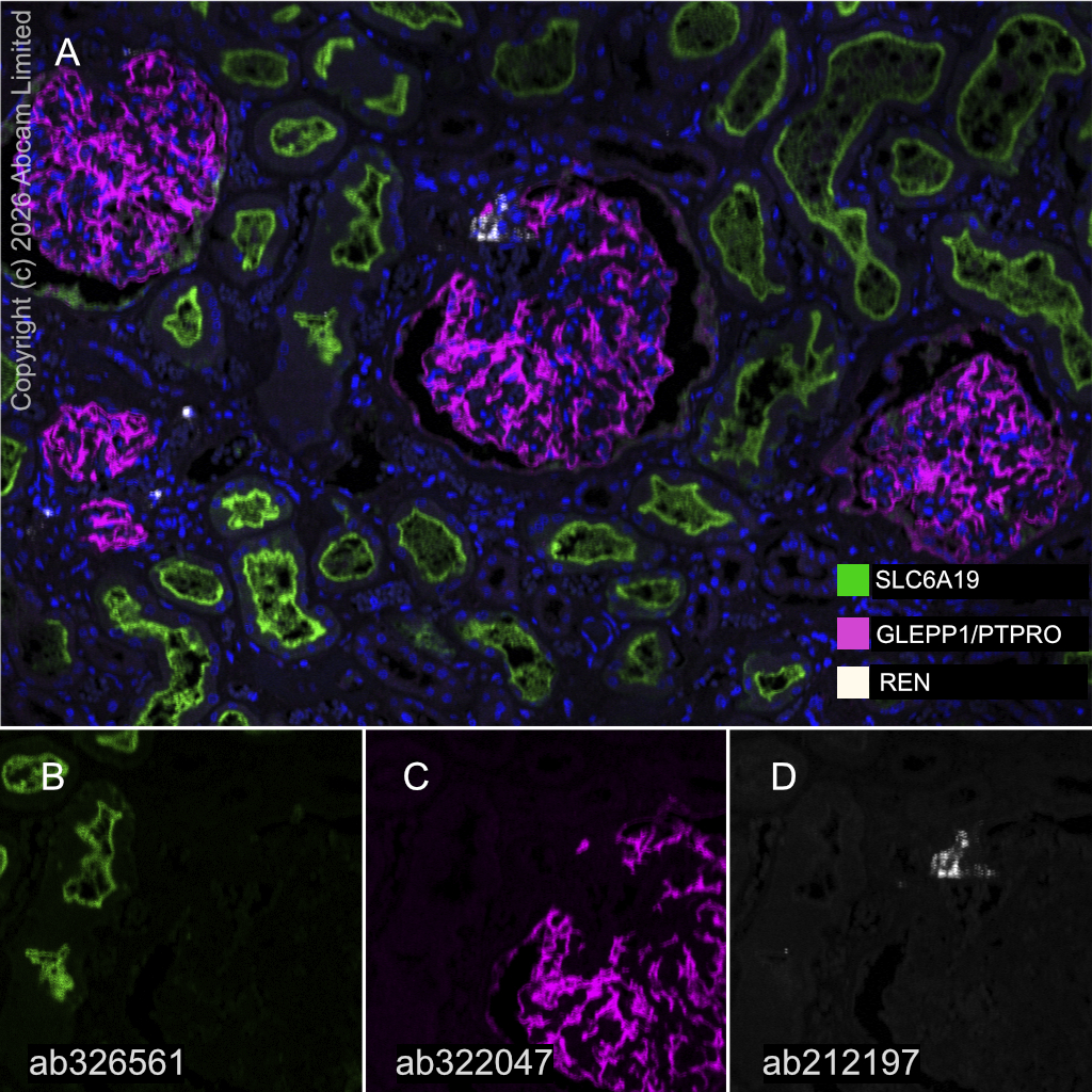 Multiplex immunohistochemistry - Anti-Renin antibody [EPR20693] (AB212197)