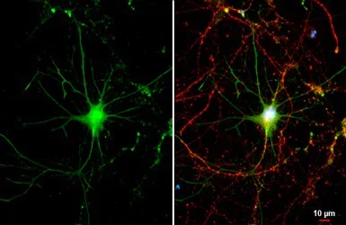 Immunocytochemistry/ Immunofluorescence - Anti-Renin Receptor antibody (AB151241)