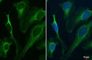 Immunocytochemistry/ Immunofluorescence - Anti-Renin Receptor antibody (AB151241)