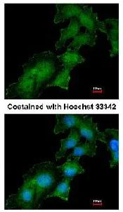 Immunocytochemistry/ Immunofluorescence - Anti-Renin Receptor antibody (AB151241)