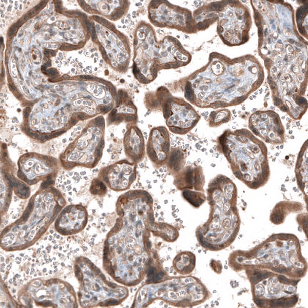 Immunohistochemistry (Formalin/PFA-fixed paraffin-embedded sections) - Anti-Renin Receptor antibody (AB264763)