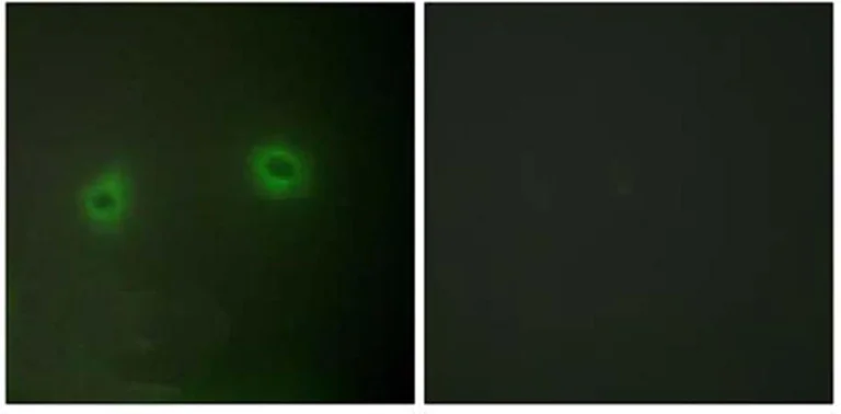 Immunocytochemistry/ Immunofluorescence - Anti-Renin Receptor antibody (AB64957)