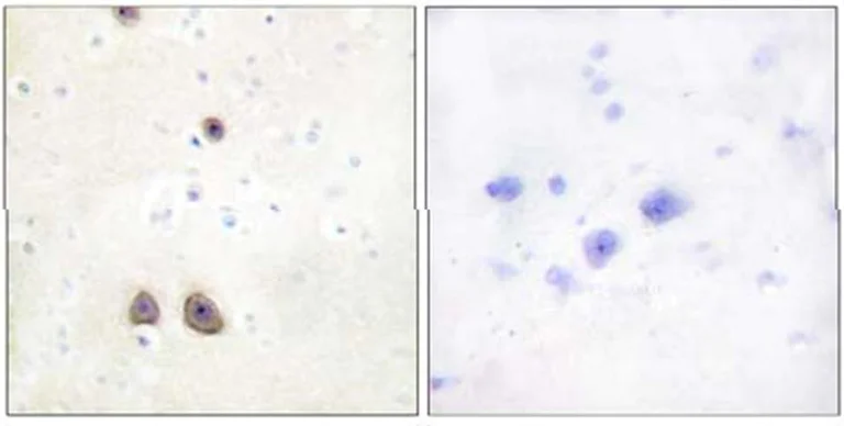 Immunohistochemistry (Formalin/PFA-fixed paraffin-embedded sections) - Anti-Renin Receptor antibody (AB64957)