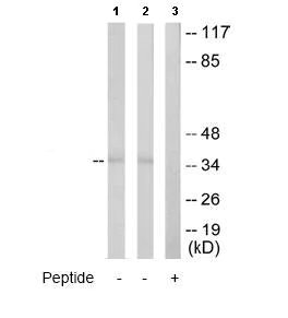 Western blot - Anti-Renin Receptor antibody (AB64957)