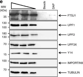 Western blot - Anti-RENT1/hUPF1 antibody (AB86057)
