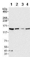 Western blot - Anti-RENT1/hUPF1 antibody (AB86057)