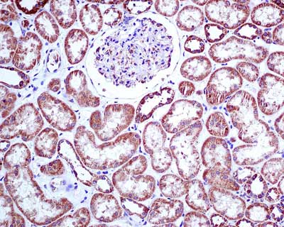 Immunohistochemistry (Formalin/PFA-fixed paraffin-embedded sections) - Anti-RENT1/hUPF1 antibody [EPR4681] (ab109363), expandable thumbnail