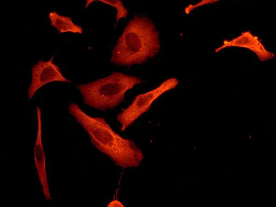 Immunocytochemistry/ Immunofluorescence - Anti-RENT1/hUPF1 antibody [EPR4681] - BSA and Azide free (AB243911)
