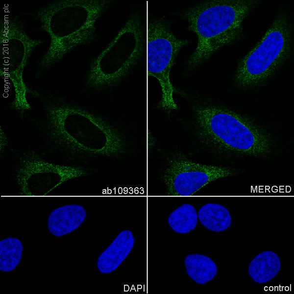Immunocytochemistry/ Immunofluorescence - Anti-RENT1/hUPF1 antibody [EPR4681] - BSA and Azide free (ab243911), expandable thumbnail