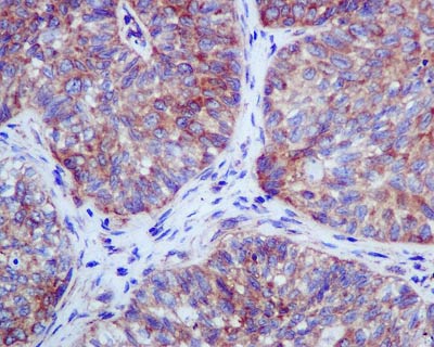 Immunohistochemistry (Formalin/PFA-fixed paraffin-embedded sections) - Anti-RENT1/hUPF1 antibody [EPR4681] - BSA and Azide free (ab243911), expandable thumbnail
