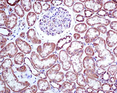 Immunohistochemistry (Formalin/PFA-fixed paraffin-embedded sections) - Anti-RENT1/hUPF1 antibody [EPR4681] - BSA and Azide free (AB243911)