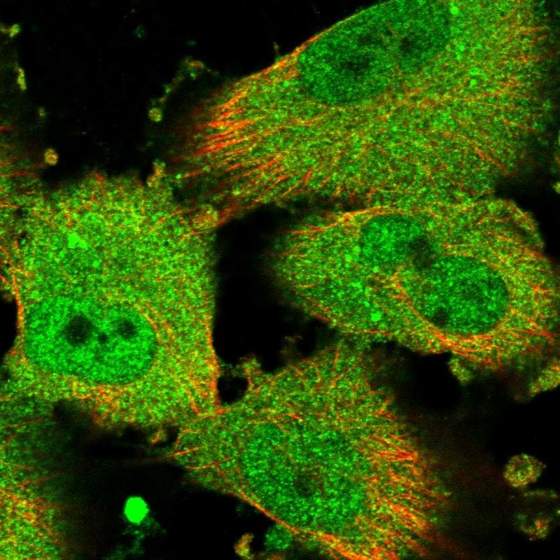 Immunocytochemistry/ Immunofluorescence - Anti-REP-2 antibody (AB254613), expandable thumbnail