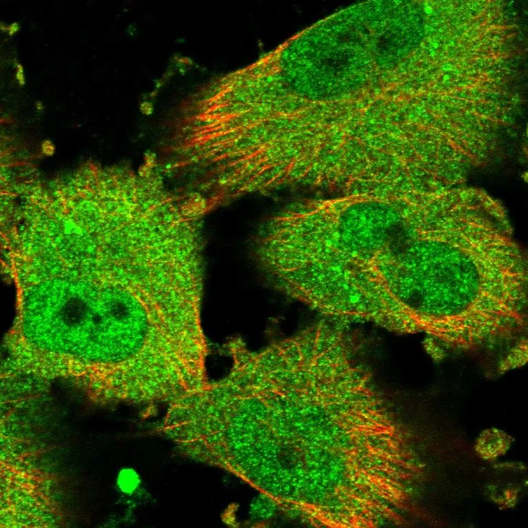 Immunocytochemistry/ Immunofluorescence - Anti-REP-2 antibody (AB254613)