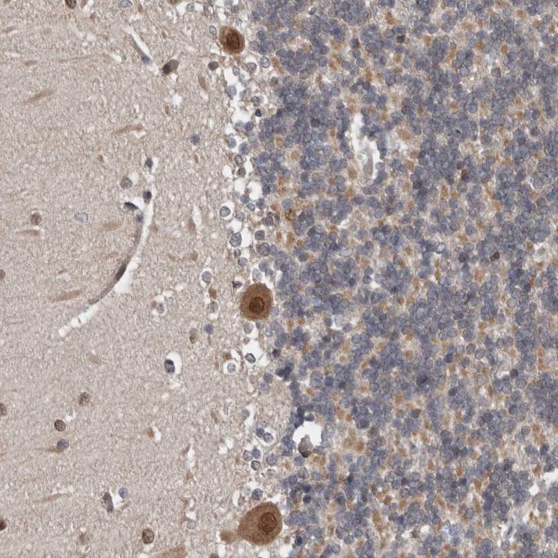 Immunohistochemistry (Formalin/PFA-fixed paraffin-embedded sections) - Anti-REP-2 antibody (AB254613), expandable thumbnail