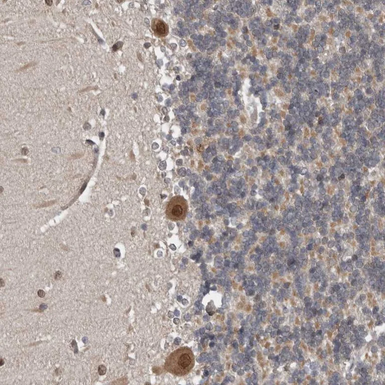 Immunohistochemistry (Formalin/PFA-fixed paraffin-embedded sections) - Anti-REP-2 antibody (AB254613)