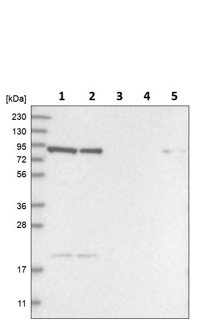 Western blot - Anti-REP-2 antibody (AB254613), expandable thumbnail