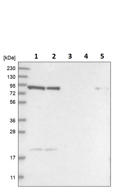 Western blot - Anti-REP-2 antibody (AB254613)