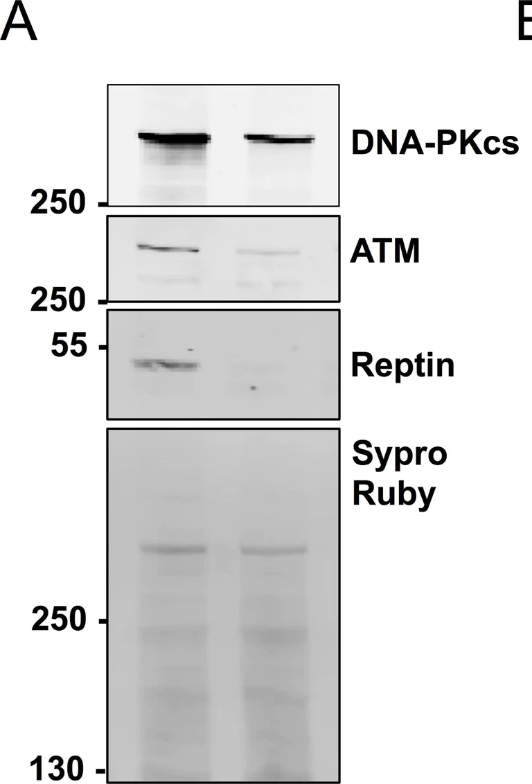 Western blot - Anti-Reptin/TIP49B/RUVB2 antibody (AB137834)