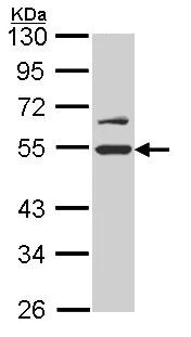 Western blot - Anti-Reptin/TIP49B/RUVB2 antibody (AB137834)