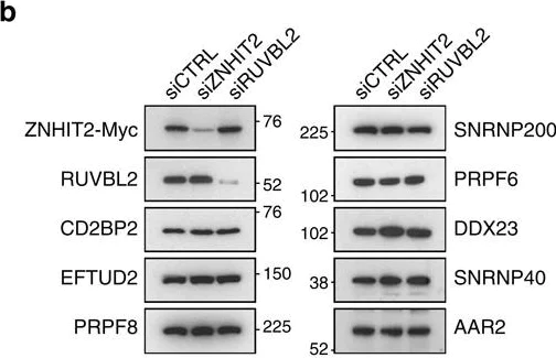 Western blot - Anti-Reptin/TIP49B/RUVB2 antibody (AB36569)