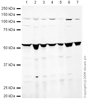 Western blot - Anti-Reptin/TIP49B/RUVB2 antibody (AB36569)