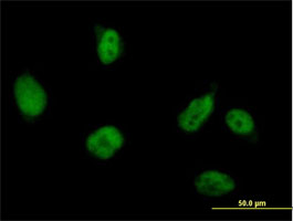 Immunocytochemistry/ Immunofluorescence - Anti-Reptin/TIP49B/RUVB2 antibody (AB89942)
