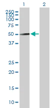 Western blot - Anti-Reptin/TIP49B/RUVB2 antibody (AB89942)