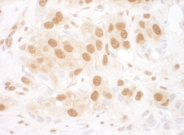 Immunohistochemistry (Formalin/PFA-fixed paraffin-embedded sections) - Anti-Reptin/TIP49B/RUVB2 antibody (AB91462), expandable thumbnail