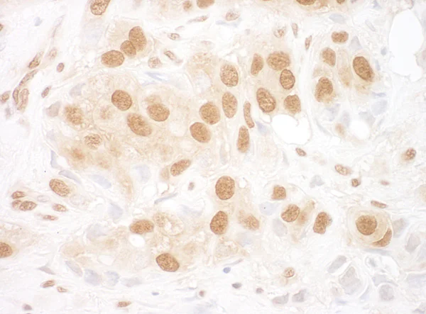 Immunohistochemistry (Formalin/PFA-fixed paraffin-embedded sections) - Anti-Reptin/TIP49B/RUVB2 antibody (AB91462)