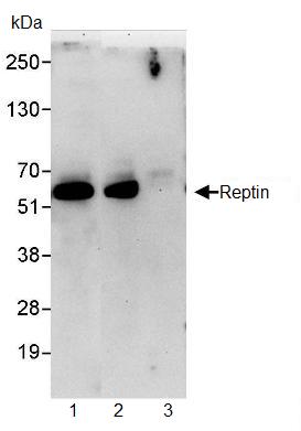 Immunoprecipitation - Anti-Reptin/TIP49B/RUVB2 antibody (AB91462), expandable thumbnail
