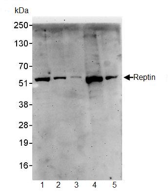 Western blot - Anti-Reptin/TIP49B/RUVB2 antibody (AB91462), expandable thumbnail
