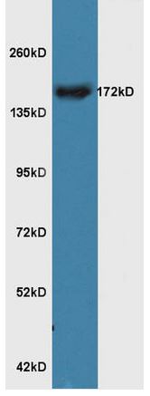 Western blot - Anti-RERE antibody (AB217756), expandable thumbnail