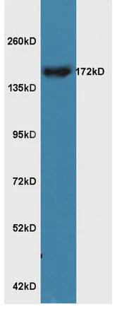 Western blot - Anti-RERE antibody (AB217756)
