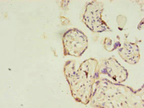 Immunohistochemistry (Formalin/PFA-fixed paraffin-embedded sections) - Anti-RERG antibody (AB235439)