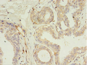 Immunohistochemistry (Formalin/PFA-fixed paraffin-embedded sections) - Anti-RERG antibody (AB235439)