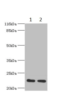 Western blot - Anti-RERG antibody (AB235439)