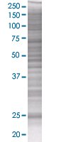 RERG overexpression 293T lysate (whole cell)
