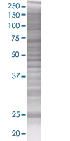 SDS-PAGE - RERG overexpression 293T lysate (whole cell) (AB94205)