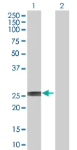 Western blot - RERG overexpression 293T lysate (whole cell) (AB94205)