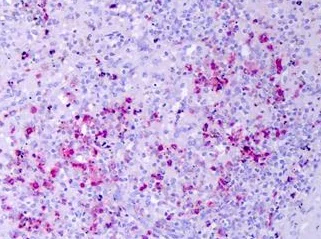 Immunohistochemistry (Formalin/PFA-fixed paraffin-embedded sections) - Anti-Resistin antibody (AB219096)