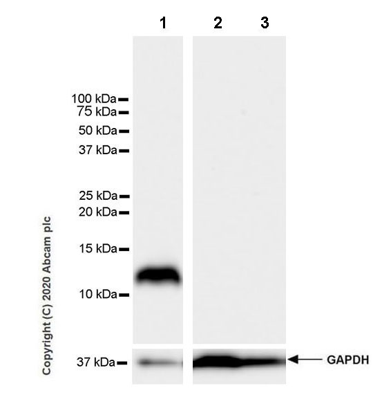 Western blot - Anti-Resistin antibody [EPR23388-272] (AB272730), expandable thumbnail