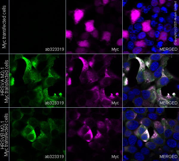 Immunocytochemistry/ Immunofluorescence - Anti-Respiratory Syncytial Virus M2-1 Protein antibody [EPR28649-58] (AB323319), expandable thumbnail