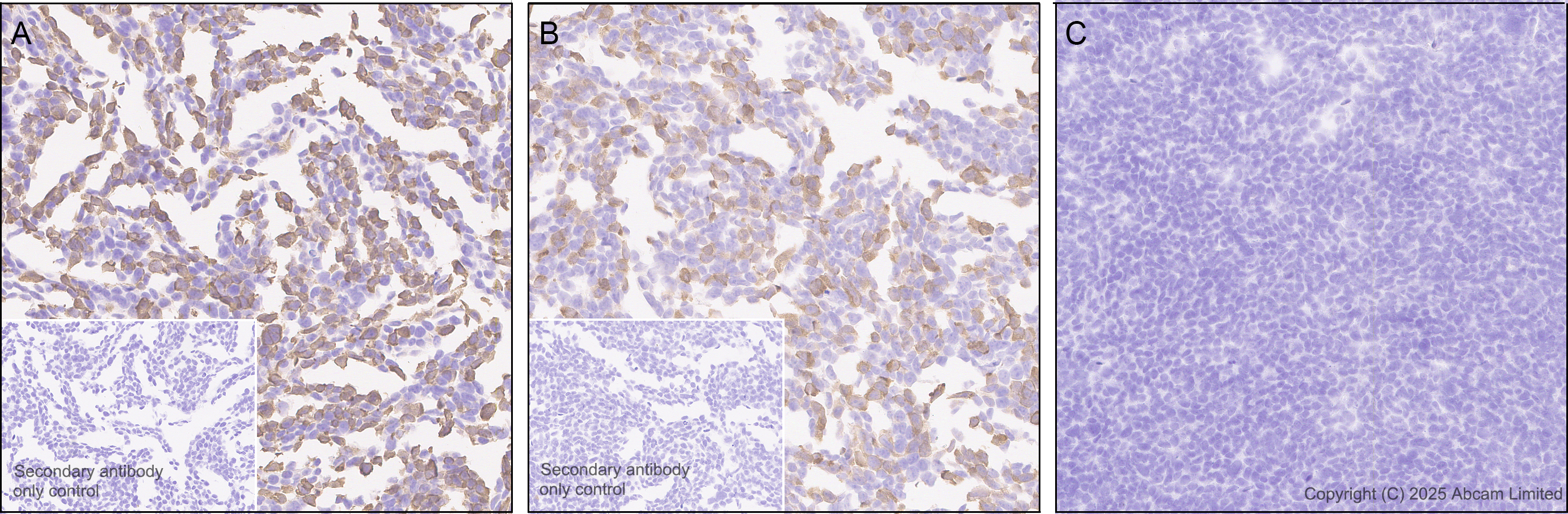 Immunohistochemistry (Formalin/PFA-fixed paraffin-embedded sections) - Anti-Respiratory Syncytial Virus M2-1 Protein antibody [EPR28649-58] (AB323319), expandable thumbnail