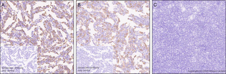 Immunohistochemistry (Formalin/PFA-fixed paraffin-embedded sections) - Anti-Respiratory Syncytial Virus M2-1 Protein antibody [EPR28649-58] (AB323319)
