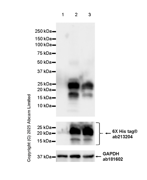 Western blot - Anti-Respiratory Syncytial Virus M2-1 Protein antibody [EPR28649-58] (AB323319), expandable thumbnail