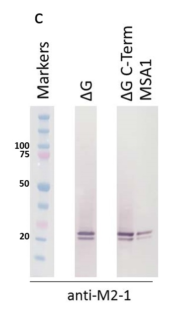 Western blot - Anti-Respiratory Syncytial Virus M2-1 Protein antibody [RSV5H5] (AB94805)